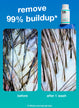 remove 99% of buildup, scalp microshot before and after.